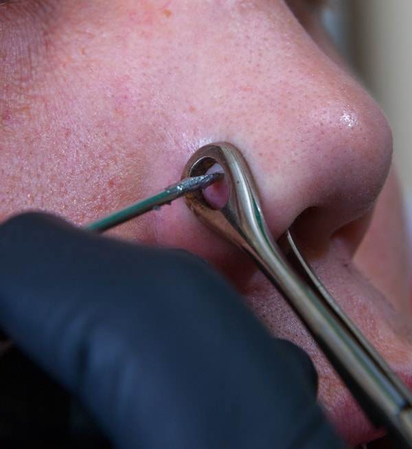 nose-piercing-procedure-722549323