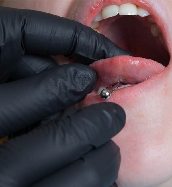 tongue-piercing-operation-627486692