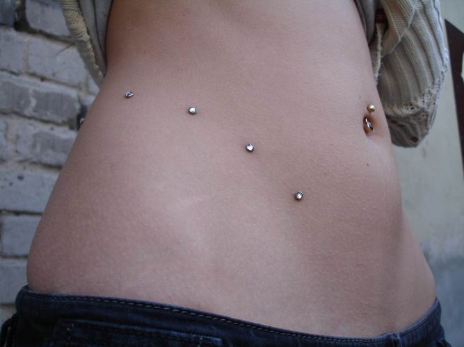 Dermal Anchor Bauch 1
