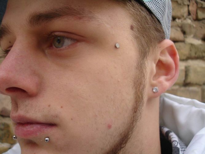 Mini Dermal Anchor 1