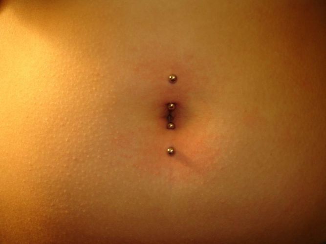 bearbeiten_bauch