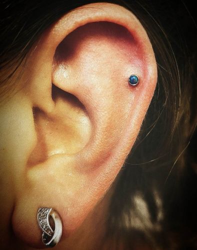 opal helix berlin